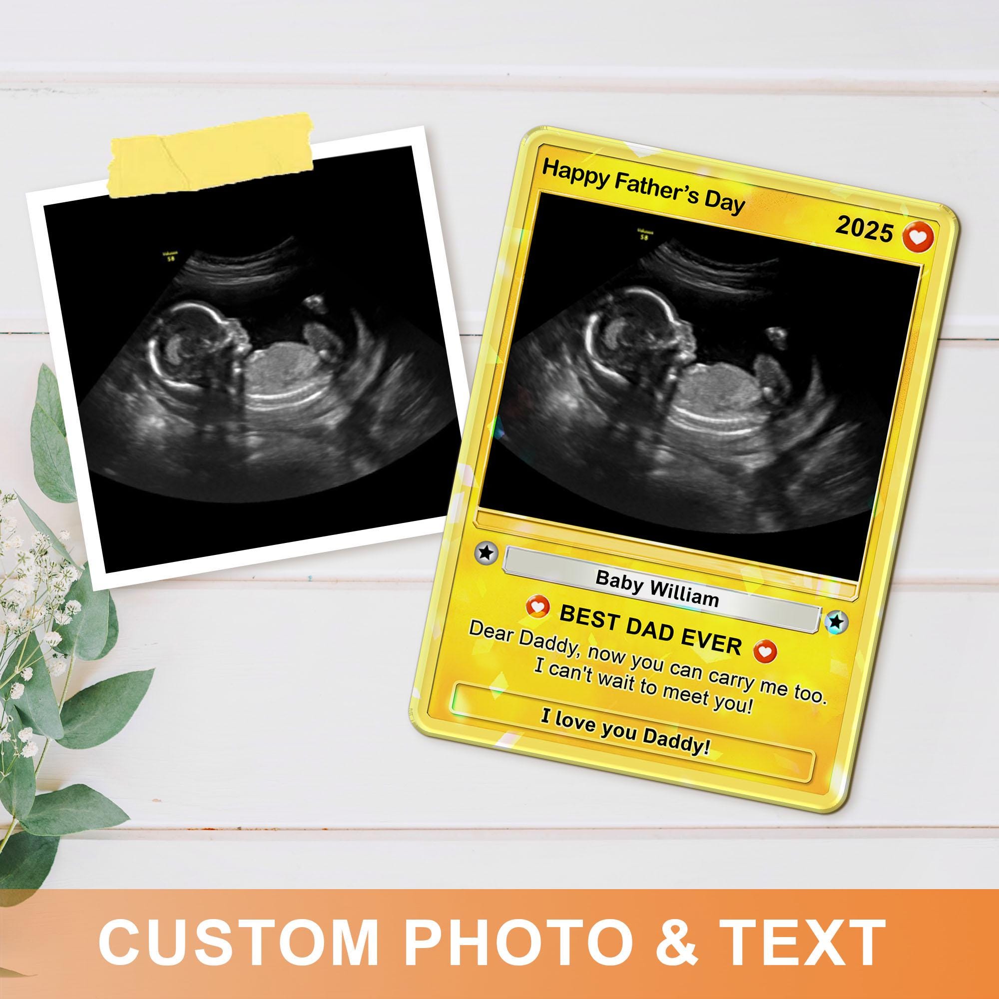 Father's Day Ultrasound Best Dad Ever Pregnancy New Dad Sonogram Hologram Wallet Card